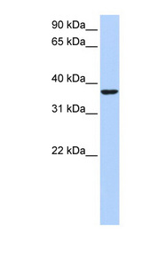 HMG20B / BRAF35 antibody LS-C110071 Western blot of HepG2 cell lysate.