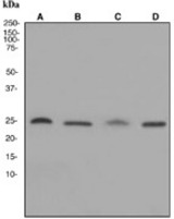 Western blot analysis on (A) HeLa, (B) 293T, (C) human placenta, and (D) JAR cell lysates using anti-Hmgb3 antibody.