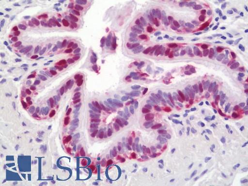 Anti-HMGB3 antibody IHC staining of human lung. Immunohistochemistry of formalin-fixed, paraffin-embedded tissue after heat-induced antigen retrieval. Antibody LS-B11156 dilution 1:100.
