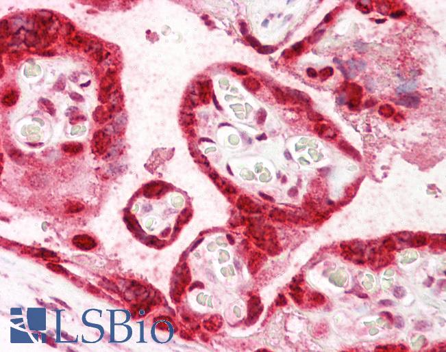 Anti-HMGB3 antibody IHC of human placenta. Immunohistochemistry of formalin-fixed, paraffin-embedded tissue after heat-induced antigen retrieval. Antibody LS-B7239 concentration 10 ug/ml.