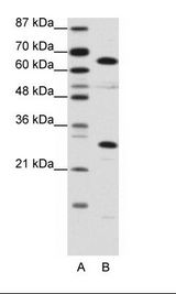 A: Marker, B: Jurkat Cell Lysate