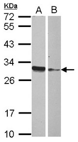 Sample (30 ug of whole cell lysate) A: IMR32 B: MCF-7 12% SDS PAGE HMGB4 antibody diluted at 1:1000
