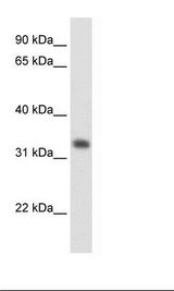 Fetal Liver Lysate