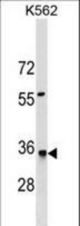 HMGCL Antibody western blot of K562 cell line lysates (35 ug/lane). The HMGCL antibody detected the HMGCL protein (arrow).