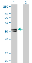 Western Blot analysis of HMGCS2 expression in transfected 293T cell line by HMGCS2 monoclonal antibody (M06), clone 1E9.Lane 1: HMGCS2 transfected lysate(56.6 KDa).Lane 2: Non-transfected lysate.