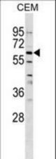 GPNMB Antibody western blot of CEM cell line lysates (35 ug/lane). The GPNMB antibody detected the GPNMB protein (arrow).