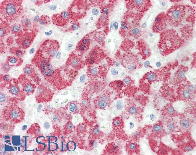 Anti-HMGCS2 antibody IHC staining of human liver. Immunohistochemistry of formalin-fixed, paraffin-embedded tissue after heat-induced antigen retrieval.