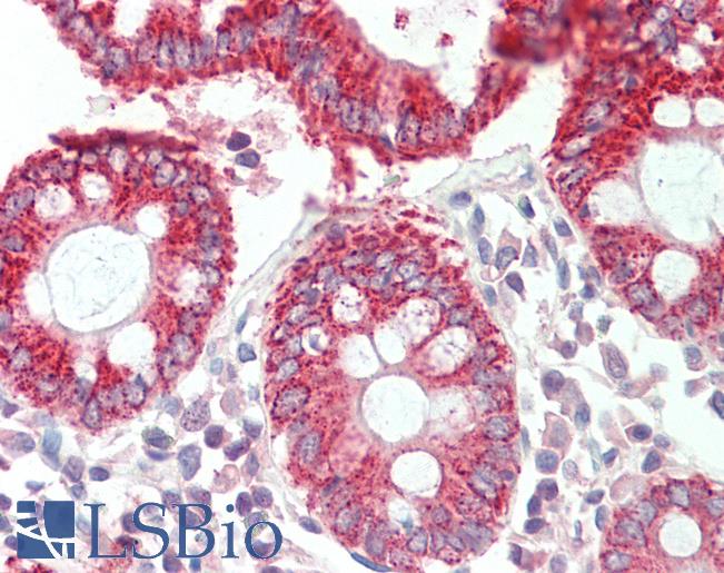 Anti-HMGCS2 antibody IHC staining of human colon. Immunohistochemistry of formalin-fixed, paraffin-embedded tissue after heat-induced antigen retrieval. Antibody LS-B11023 concentration 10 ug/ml.
