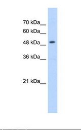 Jurkat cell lysate. Antibody concentration: 5.0 ug/ml. Gel concentration: 12%.
