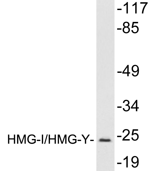 Western blot of extracts from mouse brain tissue, using HMG-I/HMG-Y antibody.