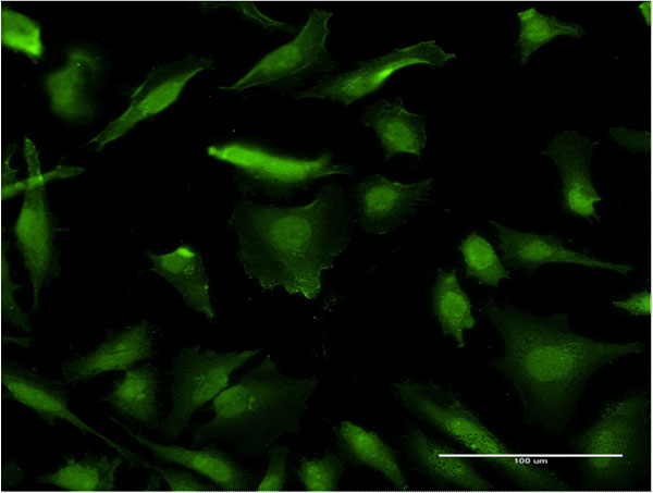 Immunofluorescence of monoclonal antibody to HMGA1 on HeLa cell . [antibody concentration 10 ug/ml]