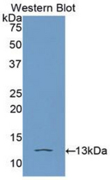 Western blot of recombinant HMGIY / HMGA1.