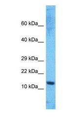 Western blot of HMGA1 Antibody with human Jurkat Whole Cell lysate.
