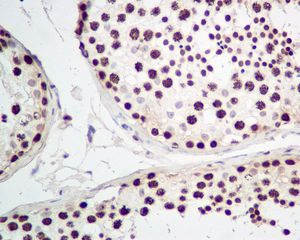 IHC of paraffin-embedded human testis tissue using anti-HMGA1 antibody.