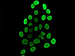 Immunofluorescent staining of BxPC-3 cells using anti-HMGA1 antibody.