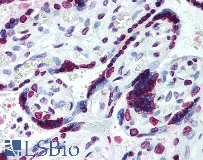 Anti-HMGA1 antibody IHC of human placenta. Immunohistochemistry of formalin-fixed, paraffin-embedded tissue after heat-induced antigen retrieval. Antibody LS-B2037 concentration 10 ug/ml.