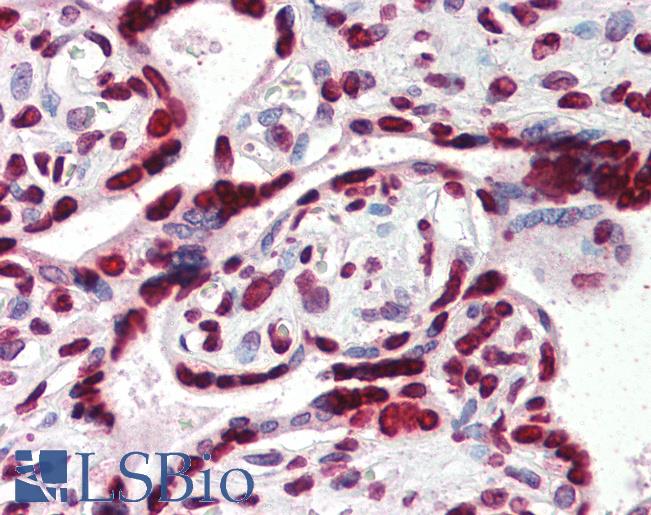 Anti-HMGA1 antibody IHC of human placenta. Immunohistochemistry of formalin-fixed, paraffin-embedded tissue after heat-induced antigen retrieval. Antibody LS-B3008 concentration 4 ug/ml.