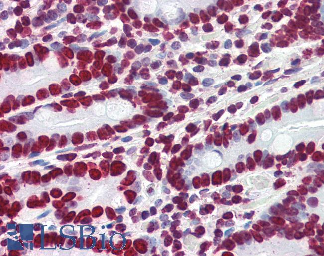 Anti-HMGA1 antibody IHC of human small intestine. Immunohistochemistry of formalin-fixed, paraffin-embedded tissue after heat-induced antigen retrieval. Antibody LS-B3008 concentration 4 ug/ml.