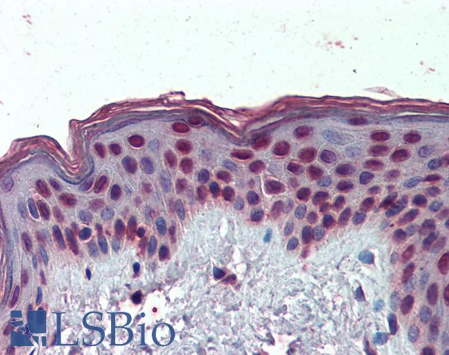 Anti-HMGA1 antibody IHC of human skin. Immunohistochemistry of formalin-fixed, paraffin-embedded tissue after heat-induced antigen retrieval. Antibody LS-B3972 concentration 3.75 ug/ml.