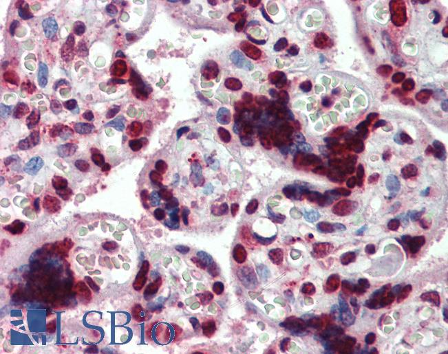 Anti-HMGA1 antibody IHC of human placenta. Immunohistochemistry of formalin-fixed, paraffin-embedded tissue after heat-induced antigen retrieval. Antibody LS-B3972 concentration 3.75 ug/ml.
