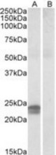 Staining (0.5 ug/ml) of Human Pancreas lysate (35 ug protein in RIPA buffer) with (B) and without (A) blocking with the immunizing peptide. Primary incubation was 1 hour. Detected by chemiluminescence.