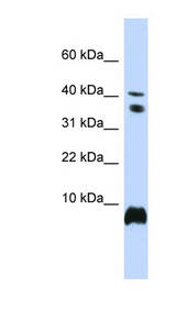 HMGN1 antibody LS-B3496 Western blot of 721_B cell lysate.