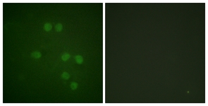 Immunofluorescence of HepG2 cells, using HMG14 (Ab-21) Antibody. The picture on the right is treated with the synthesized peptide.