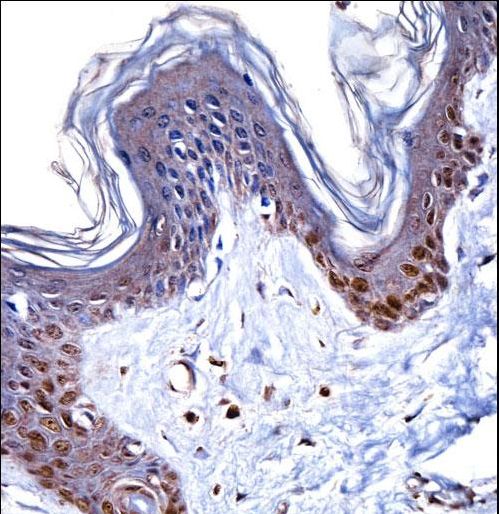 HMGN1 Antibody immunohistochemistry of formalin-fixed and paraffin-embedded human skin tissue followed by peroxidase-conjugated secondary antibody and DAB staining.