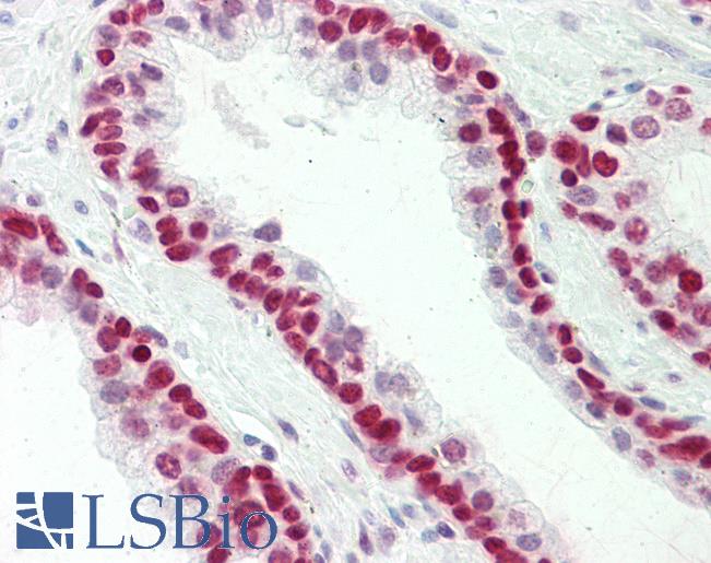 Anti-HMGN1 antibody IHC staining of human prostate. Immunohistochemistry of formalin-fixed, paraffin-embedded tissue after heat-induced antigen retrieval. Antibody LS-B10268 concentration 5 ug/ml.