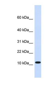 HMGN1 antibody Western blot of Fetal Heart lysate.