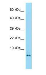 HMGN2 antibody Western Blot of Mouse Spleen.