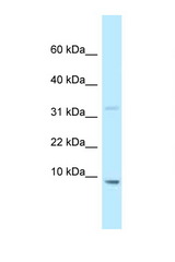 HMGN2 antibody LS-C145983 Western blot of Mouse Liver lysate. Antibody concentration 1 ug/ml.