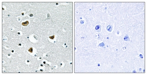 IHC of paraffin-embedded human brain tissue, using HMG17 Antibody. The sample on the right was incubated with synthetic peptide.