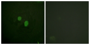 Immunofluorescence of HeLa cells, using HMG17 Antibody. The sample on the right was incubated with synthetic peptide.