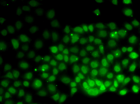 Immunofluorescence blot of HeLa cell using HMGN2 antibody.