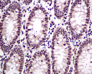 IHC of paraffin-embedded colon tissue using anti-HMGN2 antibody.