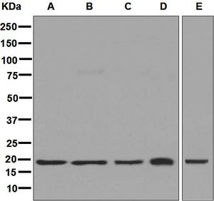 Western blot analysis on (A) HL-60, (B) K562, (C) HeLa, (D) SH-SY5Y, and (E) Jurkat cell lysates using anti-HMGN2 antibody.