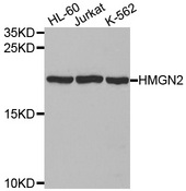 Western blot analysis of extracts of various cell lines, using HMGN2 antibody.