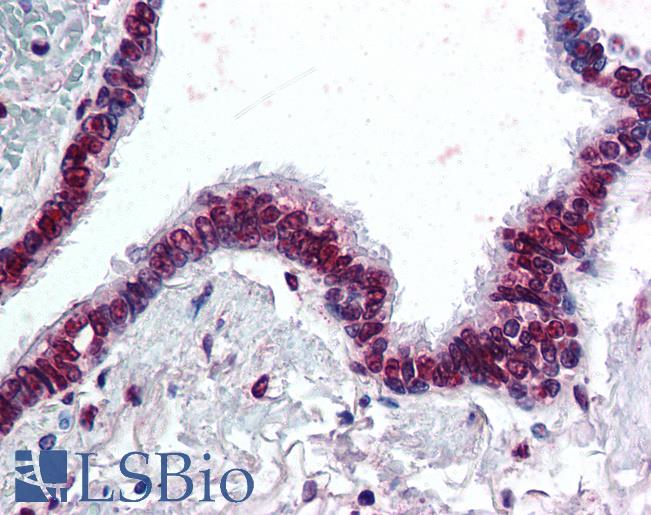 Anti-HMGN2 antibody IHC of human lung, respiratory epithelium. Immunohistochemistry of formalin-fixed, paraffin-embedded tissue after heat-induced antigen retrieval. Antibody LS-B2000 dilution 1:50.