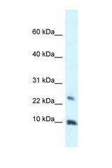 HMGN3 antibody LS-C145631 Western blot of 721_B Cell lysate. Antibody concentration 1 ug/ml.