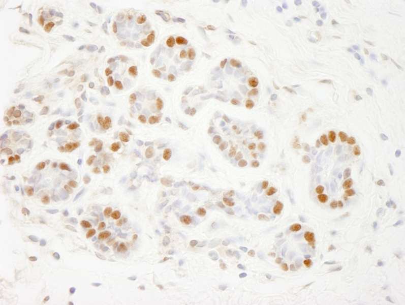 Detection of Human HMGN3 by Immunohistochemistry. Sample: FFPE section of human breast. Antibody: Affinity purified rabbit anti-HMGN3 used at a dilution of 1:500.