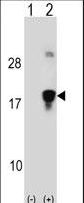 Western blot of HMGN3 (arrow) using rabbit polyclonal HMGN3 Antibody. 293 cell lysates (2 ug/lane) either nontransfected (Lane 1) or transiently transfected (Lane 2) with the HMGN3 gene.