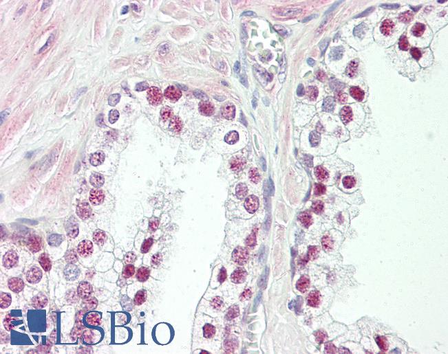 Anti-HMGXB3 antibody IHC of human prostate. Immunohistochemistry of formalin-fixed, paraffin-embedded tissue after heat-induced antigen retrieval. Antibody LS-B8408 dilution 5 ug/ml.