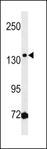 Western blot of lysate from Jurkat cell line, using HMGXB3 Antibody. Antibody was diluted at 1:1000 at each lane. A goat anti-rabbit IgG H&L (HRP) at 1:5000 dilution was used as the secondary antibody. Lysate at 35ug per lane.