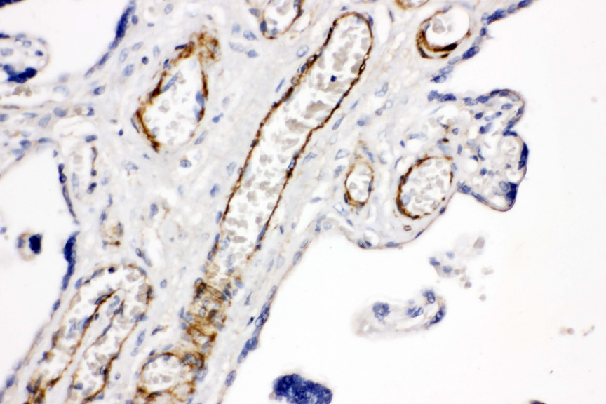 HMMR / CD168 / RHAMM antibody. IHC(P): Human Placenta Tissue.