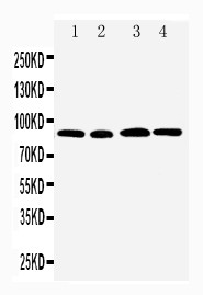 WB of HMMR / CD168 / RHAMM antibody. All lanes: Anti-HMMR at 0.5ug/ml. Lane 1: MM231 Whole Cell Lysate at 40ug. Lane 2: MM453 Whole Cell Lysate at 40ug. Lane 3: HELA Whole Cell Lysate at 40ug. Lane 4: A549 Whole Cell Lysate at 40ug. Predicted bind size: 84KD. Observed bind size: 90KD.