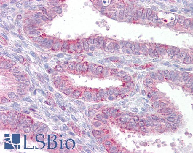 Anti-HMMR / RHAMM antibody IHC of human uterus. Immunohistochemistry of formalin-fixed, paraffin-embedded tissue after heat-induced antigen retrieval. Antibody LS-B7037 concentration 5 ug/ml.