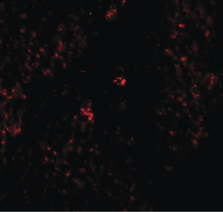 Immunofluorescence of RHAMM in human stomach tissue with RHAM antibody at 20 ug/ml.