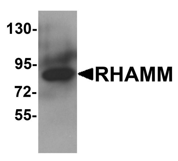 Western blot analysis of RHAMM in rat stomach tissue lysate with RHAMM antibody at 1 ug/ml.