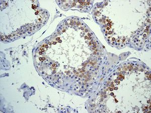 IHC of paraffin-embedded human testis tissue using anti-CD168 /RHAMM antibody.